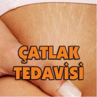 Çatlak Tedavisi (@catlakbakimi) | Twitter