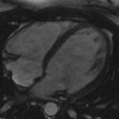 Cardiac MRI Profile