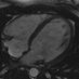 Cardiac MRI (@cardiac_mri) Twitter profile photo Cardiac MRI (@cardiac_mri) Twitter profile photo