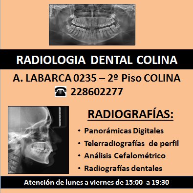 Radiología Dental y Maxilofacial
Ortopantomografía (Rx Panorámica)
Teleradiografía de perfil
Análisis cefalomético