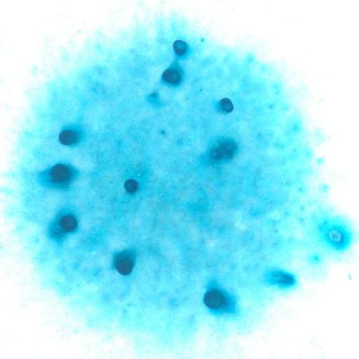 We study receptor tyrosine kinase signaling in mammalian craniofacial development @CUAnschutz.