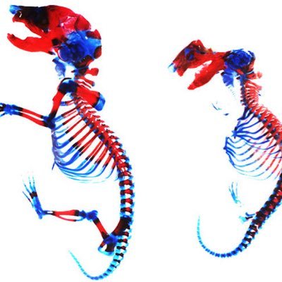 Matthew J. Hilton, PhD is an Associate Professor in the Departments of Orthopaedic Surgery and Cell Biology at Duke University School of Medicine.