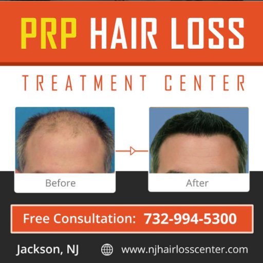 Experiencing hair loss? Call today for a free consultation. 732-994-9300

Say you heard it from Twitter!