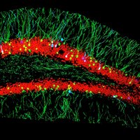 Soderling Lab(@SoderlingLab) 's Twitter Profile Photo