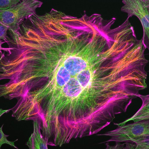 @Joe_Stains lab. Discovering the molecules and pathways that regulate bone. #osteoblast #osteocyte #cytoskeleton #sclerostin #gapjunction #bone #science