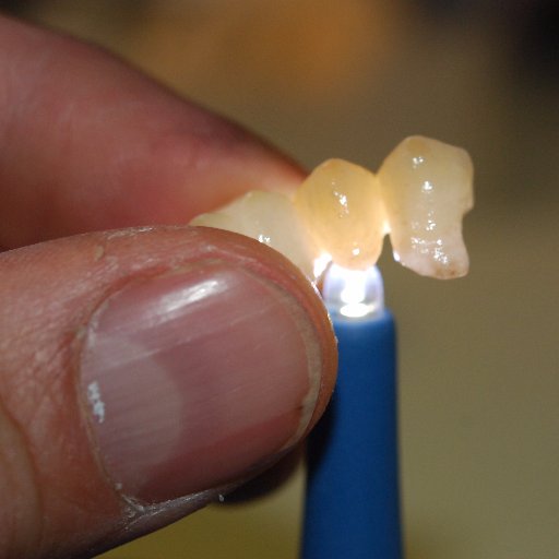 Estetica dentale digitale