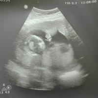 Ruh hali karışık (@bbahitli) Twitter profile photo