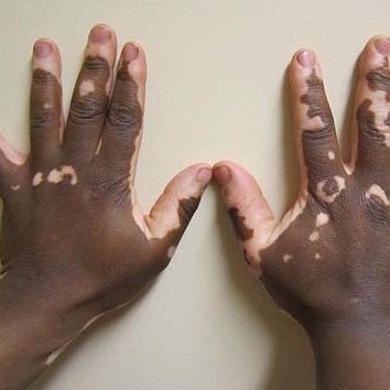 JPigmentDisord's profile picture. Dermatology and Dermatologic Diseases