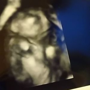匿名 無脳症ママ 3dエコーでこの子を見た時 とてもかわいくて幸せで愛おしくて まばたきひとつで 目をかくしぐさで へその緒を触る手癖がほんとに愛おしい 命なんだって 生きてるんだって伝えてくれてる 匿名 無脳症ママ 3dエコーでこの子を見た時 とてもかわいくて幸せで愛おしくて まばたきひとつで 目をかくしぐさで へその緒を触る手癖がほんとに愛おしい 命なんだって 生きてるんだって伝えてくれてる