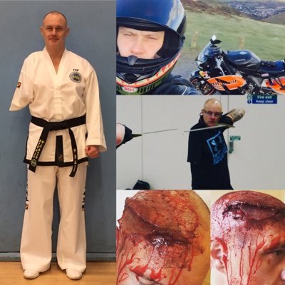 Profession; Casualty Amputee / Tv & Film Actor/Extra/SPACT / SIA DS. Motorbiker, mountain Biker, Runner, swimmer, ITF Taekwon-Do Black Belt practitioner