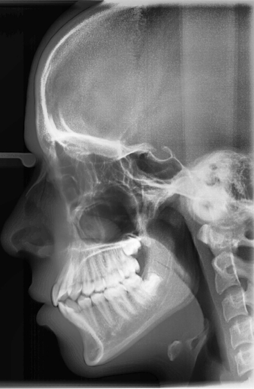 infernet89's profile picture. I like to stay on both sides of gaming. Most tweets here are in italian, because i LOVE that language! I don't like limit myself to 160 characters, because th