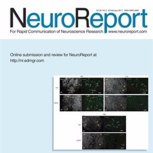 #NeuroReport publishes new findings in the field of #neuroscience. We're woke on #neuroscience
Impact Factor = 1.394 💪🏾