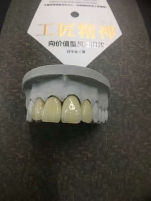 I am Jackey. from bester dental lab China
We Are A Professional Outsourcing dental lab.
if you are looking for please contact me.