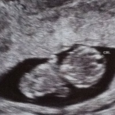 sepulelacolmena's profile picture. 