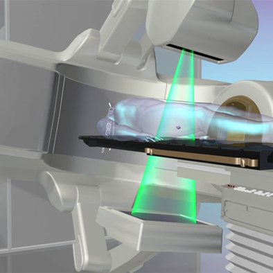 Lincoln Radiotherapy