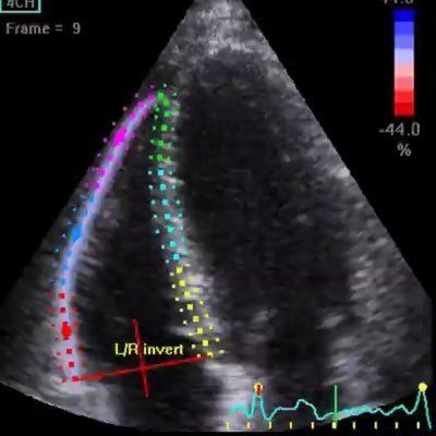 | Cardiothoracic Research from Glasgow | Own views |