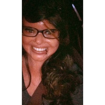 Harlequin Ichthyosis Stephanie Turner