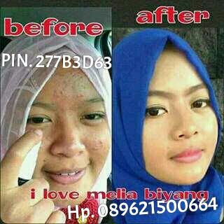 ShereAgung's profile picture. Member of Melia Sehat Sejahtera|| PIN.  277B3D63 Hp. 089621500664