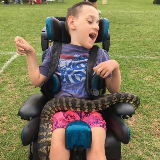 Determined & energetic, born 9 wks #premature- #visionimpairment #quadriplegic #cerebralpalsy #epilepsy #nonverbal & beat liver #cancer  Raising Awareness