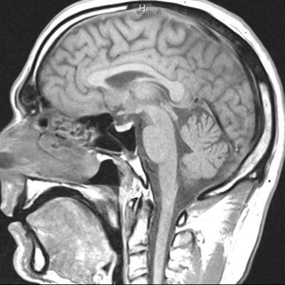 Pain | Non-pharma interventions | Measurement | Mechanisms | Causation | Likes: patients & data | Dislikes: bias & misinformation