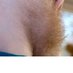 Body Hair Lover (@bodyhairlover) Twitter profile photo Body Hair Lover (@bodyhairlover) Twitter profile photo