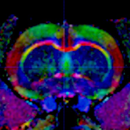 Biomarker Research and Imaging for Neuroscience