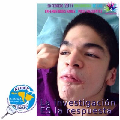dasilvahumberto's profile picture. Asociacion Civil Humberto Da Silva. Enfermedades poco frecuentes. Genéticas-Mucopolisacaridosis,Fabry,Gaucher, Leucodistrofia,Pompe,Ehlers Danlos,Marfan
