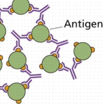 I'm a foreign toxin or disease that sparks the immune system to take action