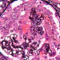 Rush Nephrology (@rush_nephrology) 's Twitter Profile