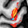 layerfMRI's profile picture. I try to collect talks, papers, and news regarding layer-fMRI.
With focus on MRI acquisition at high resolution.
