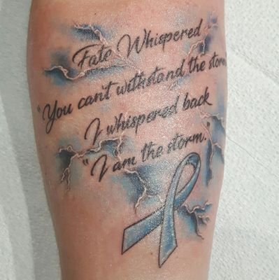 Patient diagnosed with Schnitzlers Syndrome and Patient Advocate for those diagnosed with Rare Diseases / Disorders