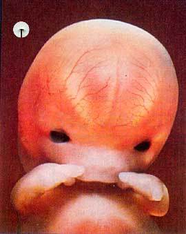 This account is for aborted tweets & 50 mil who were aborted from life on Twitter
