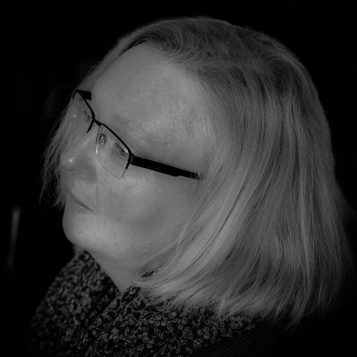 Wife, mum, worker and brain tumour fighter with one working eye thanks to my uninvited Brain Tumour.