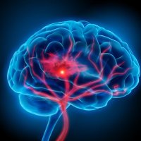 SWBH Stroke (@swbhstroke) 's Twitter Profile