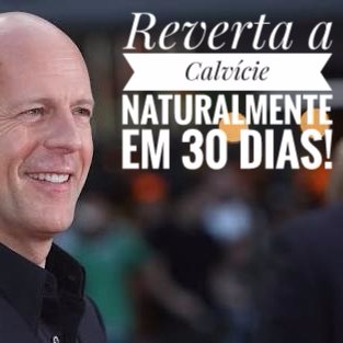 Alexsandro_Ofic's profile picture. REVERTA A CALVICE NATURALMENTE EM 30 DIAS!