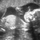 Matt Bertram - @msuwigwam - Twitter