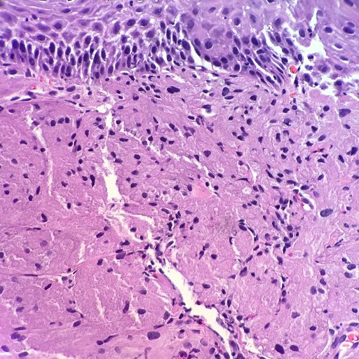 GIpathlove's profile picture. GI/Liver pathologist.