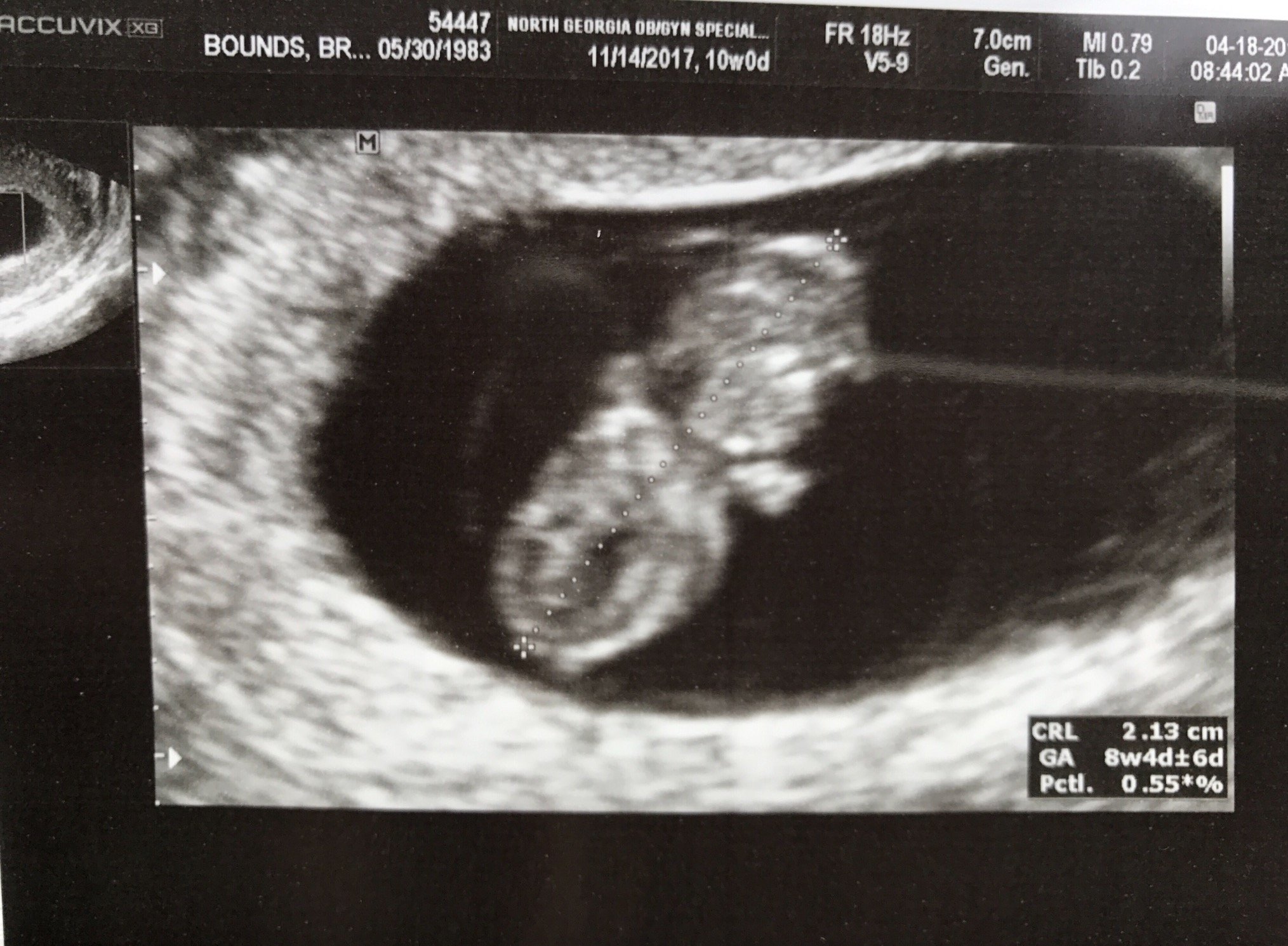 brandy_bounds's profile picture. 