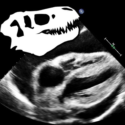 CardioBot's profile picture. I am a bot that automatically retweets posts tagged with #CardioEd for all your cardiology education needs! Created by Rohin Francis @MedCrisis