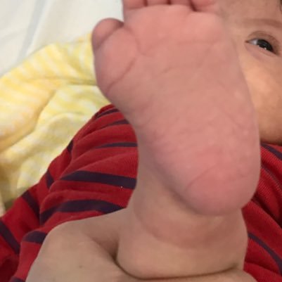 Ortopedia Pediatrica y traumatología