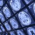 MedicsProRadiography (@mp_radiography) Twitter profile photo MedicsProRadiography (@mp_radiography) Twitter profile photo