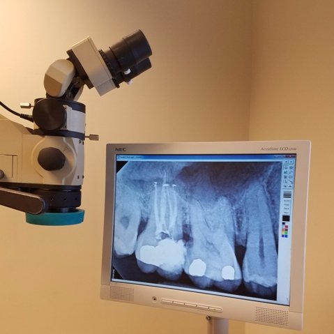 York Endodontics successfully delivers           comfortable Root Canal Therapy in York, PA.  We take pride in offering Top Quality care to our fine patients.