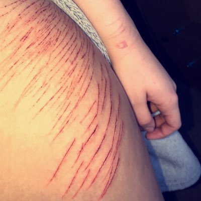 anon_affliction's profile picture. 21/anxiety/depression/bpd 💀🔪