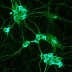 beztelesny_ru's profile picture. Кибернизация человеческого тела и нанотехнологии в повседневной жизни. Прикоснись к будущему в настоящем.