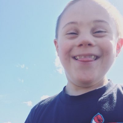 Journaling the life, struggles and successes of Jake, a child with Down syndrome. Showing the world he is a blessing with much to teach and offer the world.