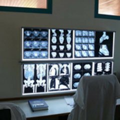 Le cabinet de radiologie Le Belvédère propose l'ensemble des services d'imagerie médicale à Paris 19e tels que la radiologie, l'échographie, mammographie...