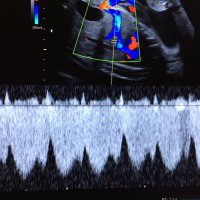 Leeds Fetal Medicine (@leedsfetal) 's Twitter Profile
