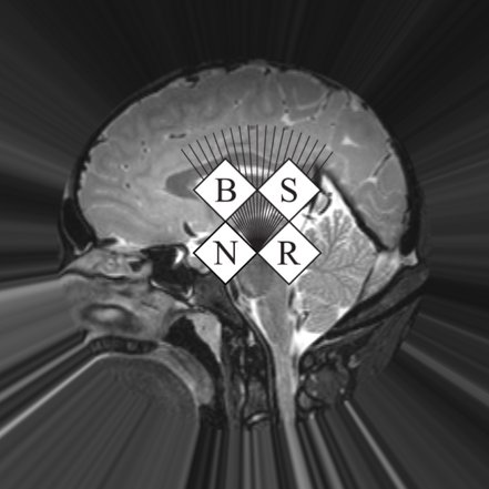 BSNRTrainees's profile picture. British Society of Neuroradiologists @TheBSNR trainee account - educational resources, cases and news for #neuroradiology trainees