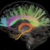 Neurosciences Sherbrooke (@cneuros) Twitter profile photo Neurosciences Sherbrooke (@cneuros) Twitter profile photo