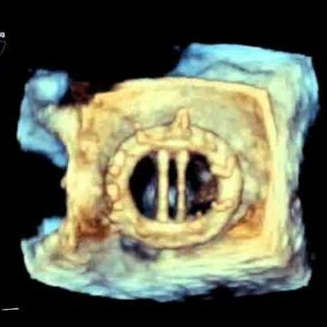 Adran Ecocardiograffeg, Uned Cardioleg ac Resbiradol❣️Echocardiography Dept, Cardiorespiratory Unit ❣️ Glangwili hospital, Hywel Dda UHB